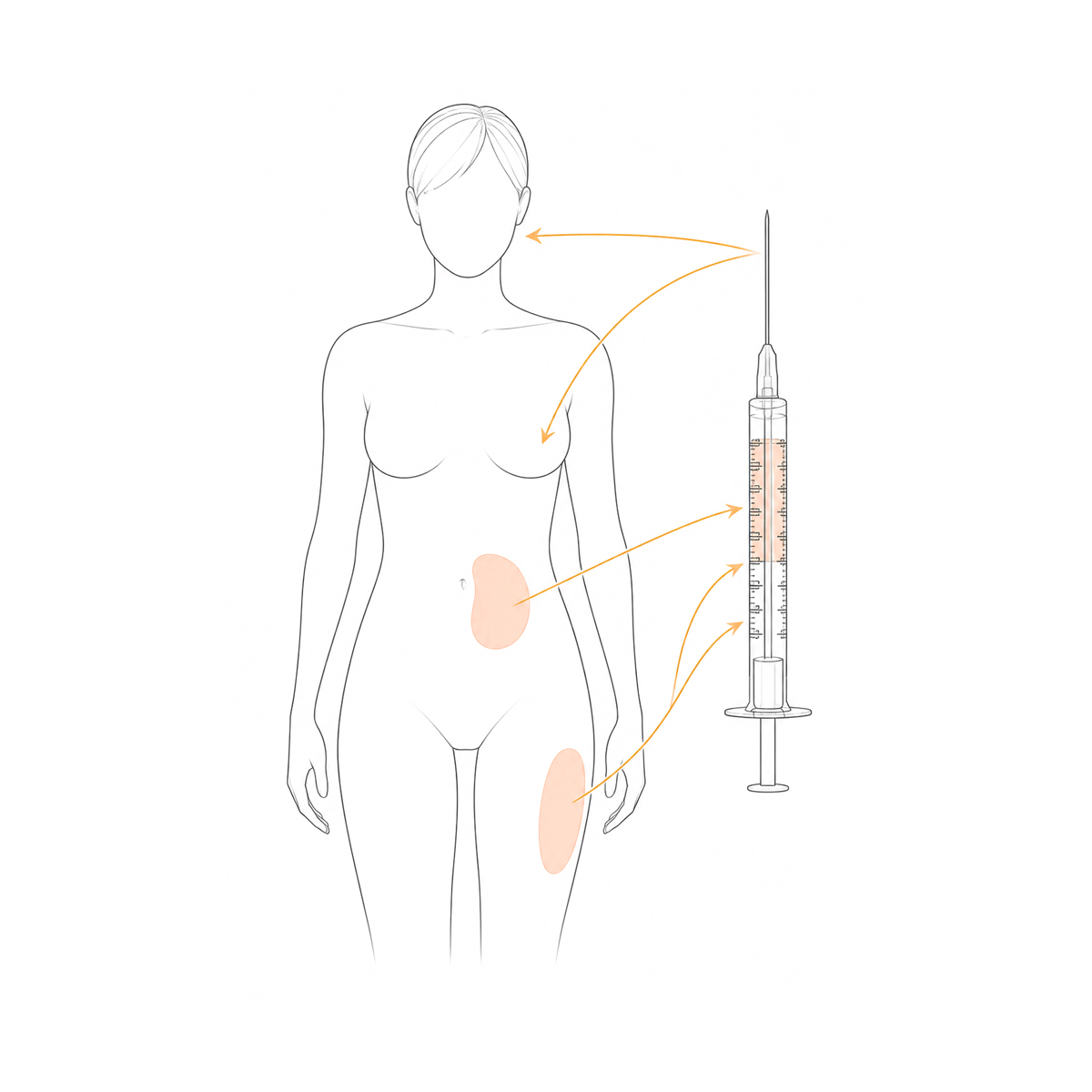 Classic breast augmentation